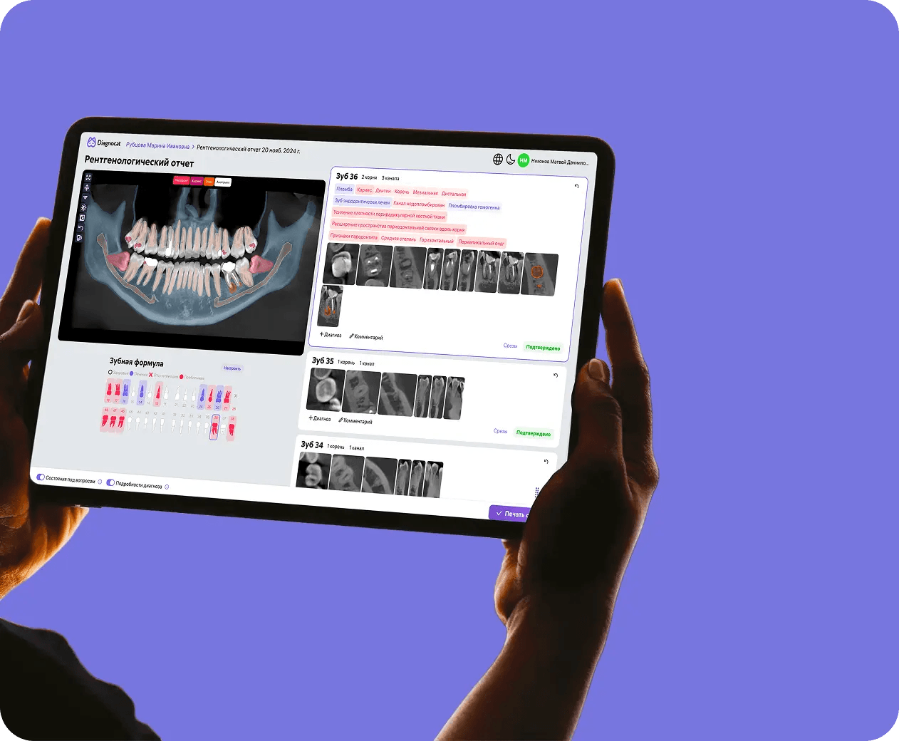 Диагностика с Diagnocat